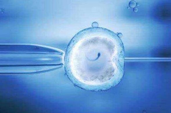 试管婴儿中为什么会出现宫腔积液，与取卵手术有很大关系